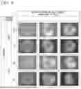 Fig. 06 - MEDIUM FOR CULTURING AND EXPANDING NEPHRON PROGENITOR CELLS, METHOD FOR CULTURING AND EXPANDING NEPHRON PROGENITOR CELLS, AND METHOD FOR PRODUCING RENAL ORGANOIDS