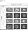 Fig. 08 - MEDIUM FOR CULTURING AND EXPANDING NEPHRON PROGENITOR CELLS, METHOD FOR CULTURING AND EXPANDING NEPHRON PROGENITOR CELLS, AND METHOD FOR PRODUCING RENAL ORGANOIDS