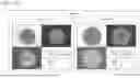 Fig. 29 - MEDIUM FOR CULTURING AND EXPANDING NEPHRON PROGENITOR CELLS, METHOD FOR CULTURING AND EXPANDING NEPHRON PROGENITOR CELLS, AND METHOD FOR PRODUCING RENAL ORGANOIDS