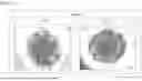 Fig. 30 - MEDIUM FOR CULTURING AND EXPANDING NEPHRON PROGENITOR CELLS, METHOD FOR CULTURING AND EXPANDING NEPHRON PROGENITOR CELLS, AND METHOD FOR PRODUCING RENAL ORGANOIDS