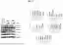 Fig. 18 - COMPOSITIONS AND METHODS TO IMPROVE IPSC-EC FUNCTION