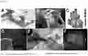 Fig. 07 - Method of early diagnosis and composition of gRNA for treating mental health diseases using genome editing and cell and gene therapy