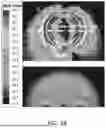 Fig. 28 - NONINVASIVE WATER CONTENT SENSOR