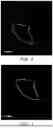 Fig. 05 - Automatic extraction of regions of interest from annotated images with occluding labels