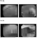 Fig. 06 - IMAGE DIAGNOSIS SYSTEM FOR LESION