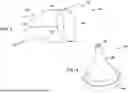 Fig. 04 - Tethers for Dynamic Gastric Bypass Device