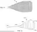 Fig. 09 - Tethers for Dynamic Gastric Bypass Device