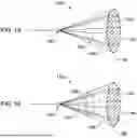Fig. 10 - Tethers for Dynamic Gastric Bypass Device