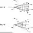 Fig. 11 - Tethers for Dynamic Gastric Bypass Device