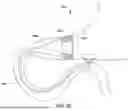 Fig. 13 - Tethers for Dynamic Gastric Bypass Device