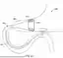 Fig. 16 - Tethers for Dynamic Gastric Bypass Device