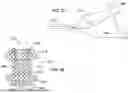 Fig. 20 - Tethers for Dynamic Gastric Bypass Device