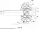 Fig. 21 - Tethers for Dynamic Gastric Bypass Device