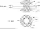 Fig. 23 - Tethers for Dynamic Gastric Bypass Device