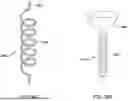 Fig. 30 - Tethers for Dynamic Gastric Bypass Device