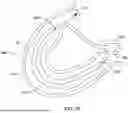 Fig. 31 - Tethers for Dynamic Gastric Bypass Device
