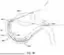 Fig. 38 - Tethers for Dynamic Gastric Bypass Device