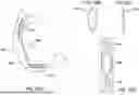 Fig. 41 - Tethers for Dynamic Gastric Bypass Device