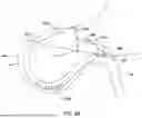 Fig. 44 - Tethers for Dynamic Gastric Bypass Device