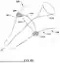 Fig. 48 - Tethers for Dynamic Gastric Bypass Device
