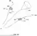 Fig. 49 - Tethers for Dynamic Gastric Bypass Device