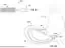 Fig. 50 - Tethers for Dynamic Gastric Bypass Device