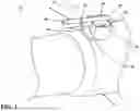 Fig. 02 - Exhaust system having a hanger assembly
