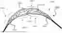 Fig. 01 - INTRALUMINAL DEVICE