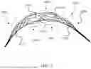 Fig. 02 - INTRALUMINAL DEVICE