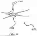 Fig. 09 - INTRALUMINAL DEVICE