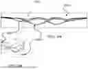 Fig. 10 - INTRALUMINAL DEVICE