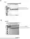 Fig. 04 - RECOMBINANT NEPROSIN POLYPEPTIDES AND METHODS OF EXPRESSION