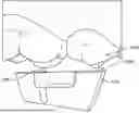 Fig. 01 - SYSTEMS AND METHODS FOR OCCLUSAL MANDIBULAR ADVANCEMENT BLOCK PLACEMENT