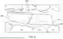 Fig. 09 - SYSTEMS AND METHODS FOR OCCLUSAL MANDIBULAR ADVANCEMENT BLOCK PLACEMENT