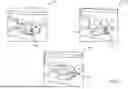 Fig. 10 - SYSTEMS AND METHODS FOR OCCLUSAL MANDIBULAR ADVANCEMENT BLOCK PLACEMENT