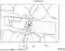 Fig. 12 - SYSTEMS AND METHODS FOR OCCLUSAL MANDIBULAR ADVANCEMENT BLOCK PLACEMENT