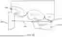 Fig. 15 - SYSTEMS AND METHODS FOR OCCLUSAL MANDIBULAR ADVANCEMENT BLOCK PLACEMENT