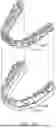 Fig. 26 - SYSTEMS AND METHODS FOR OCCLUSAL MANDIBULAR ADVANCEMENT BLOCK PLACEMENT