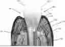 Fig. 01 - INTEGRATED TISSUE MANAGEMENT SOLUTIONS IN ORTHODONTIC ALIGNERS