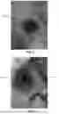 Fig. 03 - INTEGRATED TISSUE MANAGEMENT SOLUTIONS IN ORTHODONTIC ALIGNERS