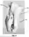 Fig. 04 - INTEGRATED TISSUE MANAGEMENT SOLUTIONS IN ORTHODONTIC ALIGNERS