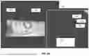 Fig. 07 - INTEGRATED TISSUE MANAGEMENT SOLUTIONS IN ORTHODONTIC ALIGNERS