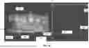 Fig. 08 - INTEGRATED TISSUE MANAGEMENT SOLUTIONS IN ORTHODONTIC ALIGNERS