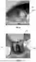 Fig. 09 - INTEGRATED TISSUE MANAGEMENT SOLUTIONS IN ORTHODONTIC ALIGNERS