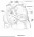 Fig. 09 - METHOD FOR TRAVERSING AN ANATOMICAL VESSEL WALL