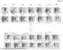 Fig. 05 - CONVOLUTIONAL NEURAL NETWORK FOR DYNAMIC PET FRAME CLUSTERING