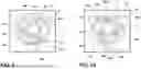 Fig. 07 - Removable bezel assembly for a cooking appliance