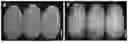 Fig. 01 - CEREAL GRAIN WITH THICKENED ALEURONE