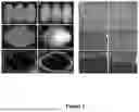 Fig. 02 - CEREAL GRAIN WITH THICKENED ALEURONE