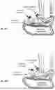 Fig. 20 - A MULTI-LEVEL FOOTWEAR SOLE